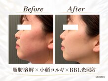 モミン(MOMI.N)の雰囲気（顔＆ボディ140分お悩みに合わせたオーダーメイドプランをご用意）