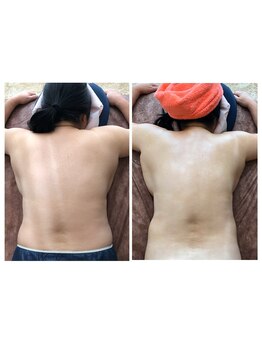 さくら整体院/深層リンパスリム120分