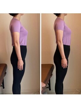 ザ エスアップ 博多店(THE S-UP)/施術前後写真