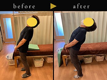 杉本接骨鍼灸院/背骨から全身がユルユル整体