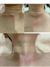 妙手堂/顔マッサージ