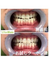 ルブラン 奈良店(Le Blanc)/これからのイベントに向けて！