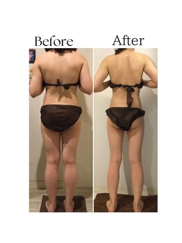 ラヴィニティ 五反田店(Lavinity)/五反田駅で痩身が人気のエステ