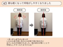 ピースフルポイント(Peaceful Point)/姿勢改善Before/After
