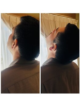 ジャルダン(Jardan)/施術後の可動域チェック