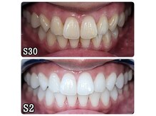 ホワイトニングセンター 広島福山駅前店