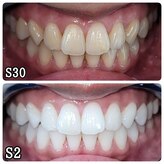 ホワイトニングセンター 広島福山駅前店