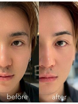 メンズ眉毛サロン&毛穴洗浄 HAK.大阪心斎橋【ハク】MEN'Sアイブロウサロン/眉毛パーマ/