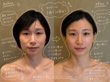 コアラル 麻布十番(COALALU)