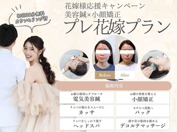 ハリカ 大阪梅田店(HARIKA)の写真/挙式までに本気で小顔を目指す花嫁様へ◎ブライダル美容鍼×小顔矯正で写真映えする理想のフェイスラインに