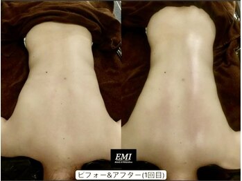 EMI 上野店/#ボディラインを整えたい
