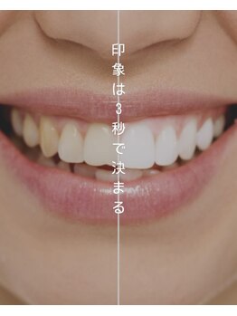 プラチナムビューティー 鳥取店(platinum beauty)/見せたくなる歯へ