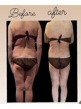 エステサロン ジュブリー/［痩身・お腹、脚、太もも、］