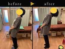 杉本接骨鍼灸院/背骨から全身がユルユル整体