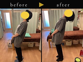 杉本接骨鍼灸院/背骨から全身がユルユル整体