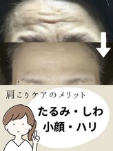 カルニッコ(Kalnicco)&nbsp;肩こりケア のメリット