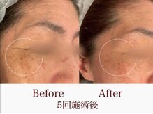 ニイヌマラボ(NIINUMA LABO)の雰囲気（しわしみの緩和、毛穴にスピード解決☆）