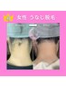 【女性】４番人気☆後ろ姿美人♪うなじ脱毛　￥1,500