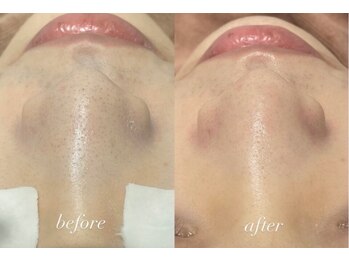 ラポール 野並店(Rapport)/