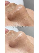 ラベル(RABEL.)/フェイシャルワックス