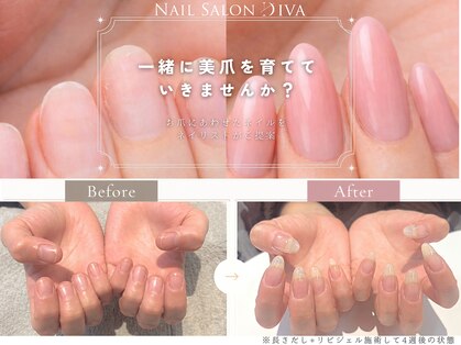ディーバ 心斎橋grace店(Diva)の写真