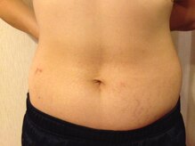 デトックス(Detox)/施術後の変化に！！！