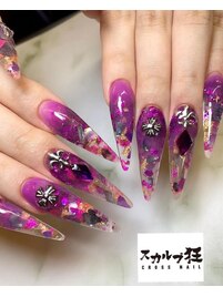 埋め込みスカルプ