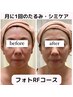 【初回】全顔2周＋お悩みスポット照射光フェイシャル　60分¥7700