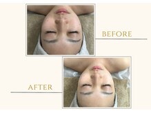 セン(Sen)/ビフォーアフター