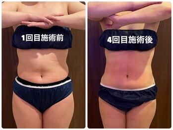 あきくに整骨院 美容整体院/1カ月の成果