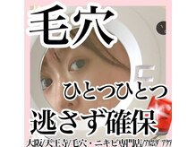 アルムダアクア 天王寺店(Aleumda AQUA)/毛穴エクストラクションプロ大阪