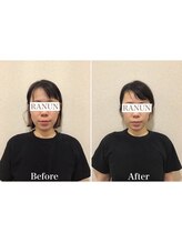 池袋東口整体院/小顔矯正