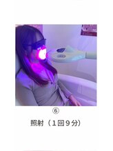 エクシアホワイト 山形西バイパス店/ホワイトニング施術の流れ