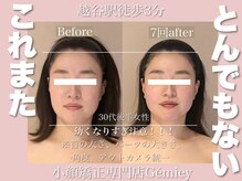 ジェイミー(Gemiey)/幼くなりすぎ注意！！