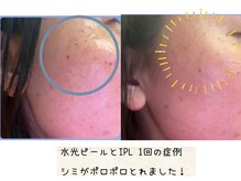 ナースセレクトサロン(Nurse select salon)/もっと早くやれば良かった