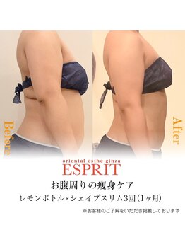 エスプリ 新宿店/レモンボトル・セルゼロ痩身