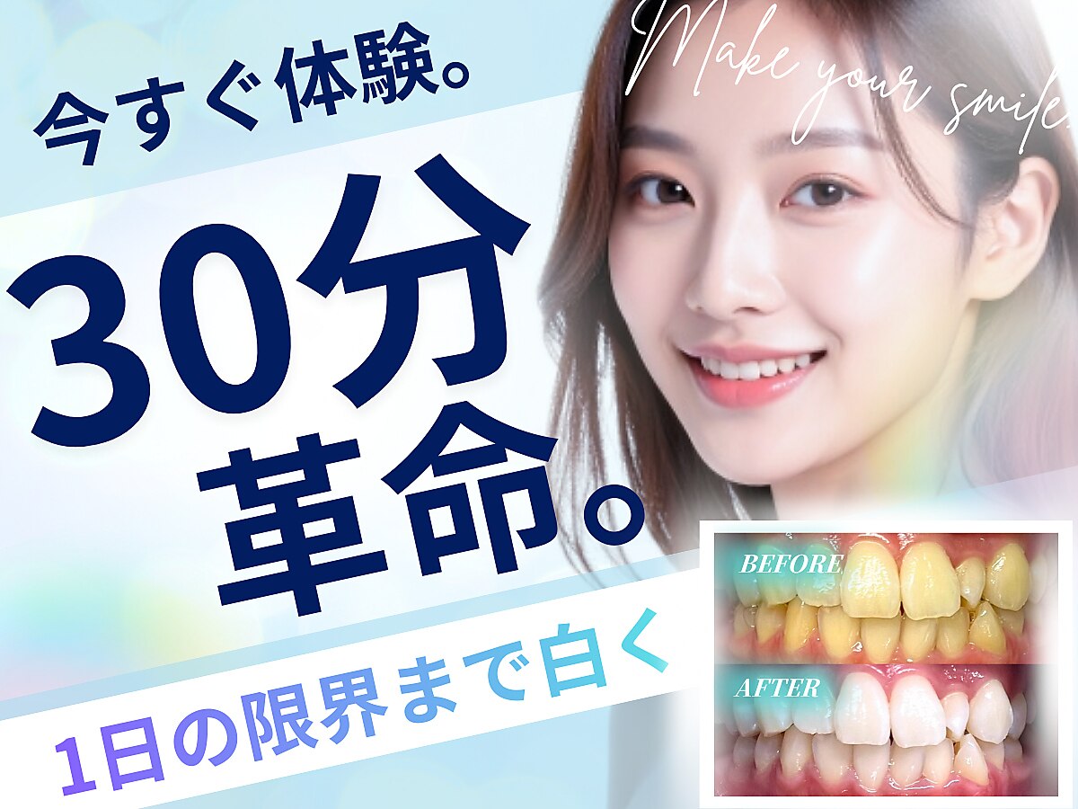 ドルチェグスト6種セット※ 歯のホワイトニング　shi Labo ドルチェ(Dolce)｜ホットペッパービューティー