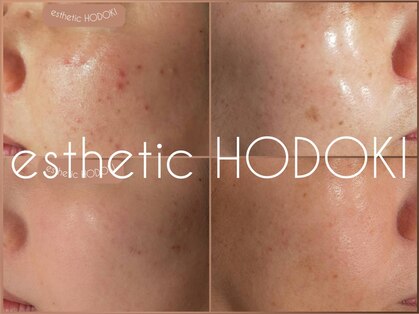エステティックホドキ(esthetic HODOKI)の写真