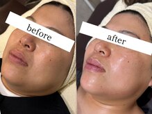 ウィズルーチェ 麻布十番店(with luce)/気になる二重アゴもお任せ下さい