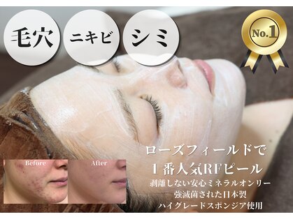 ローズフィールド(Rosefield)の写真