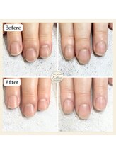 カロッス(Kallos)/ネイルケア