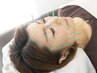 【細胞活性化！肌荒れ、乾燥、浮腫み、二重顎が気になる】美容鍼¥7700→¥5500