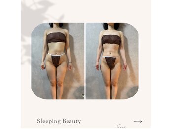 スリーピングビューティー(Sleeping Beauty)/インディバ　ボディ