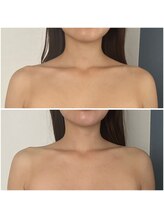 モア(moa)/オフショルの似合う首元に！