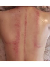 クリーン(CLEAN)/【新メニュー】台湾式美容カッサ