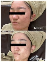 ジャスミン(Jasmin)/オーダーメイド高濃度原液導入