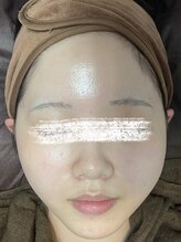 ラビ(RABBI)/20代女性プレミアムピーリング