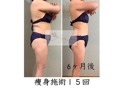 アイ エステサロン(Ai)の写真