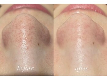 ラポール 野並店(Rapport)/