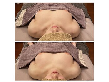 ベンザイ 新潟店(BENZAI)/下垂と背中流れのバストが離れる